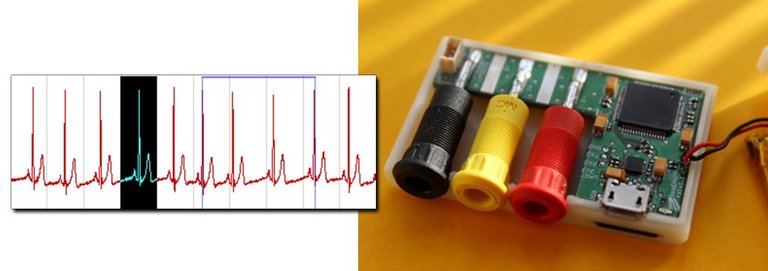 Biosignalanalyse Diagramm und Hardware